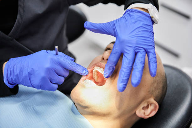 Best Emergency Dental Filling Replacement  in Worthington, MN